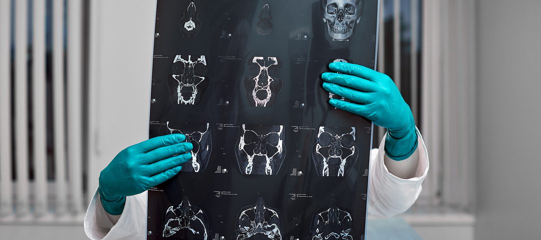 Tipos de contraste de exame: médica segura radiografia.