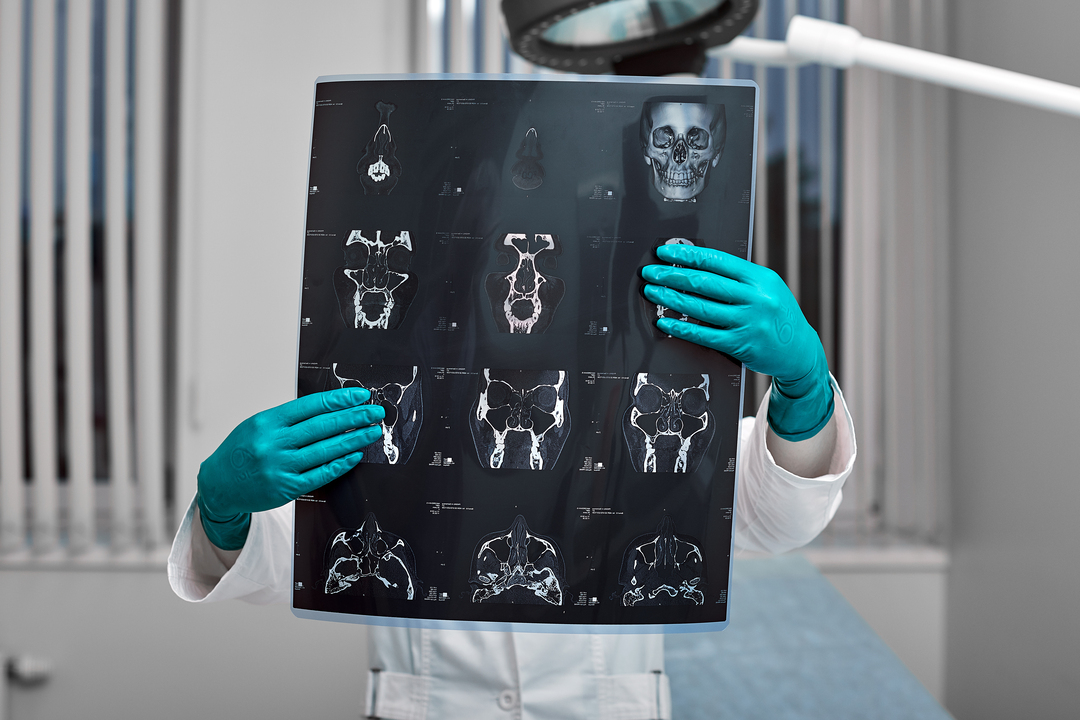 Tipos de contraste de exame: médica segura radiografia.