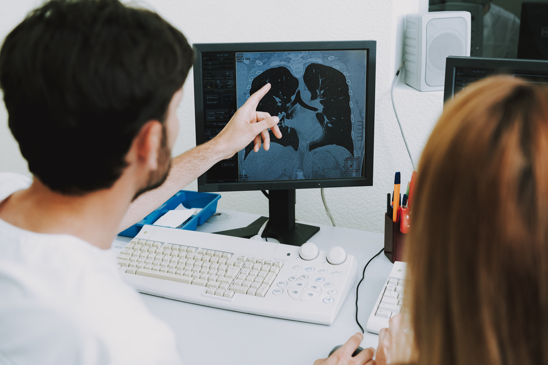 Angiotomografia: médico analisa pulmão de paciente;