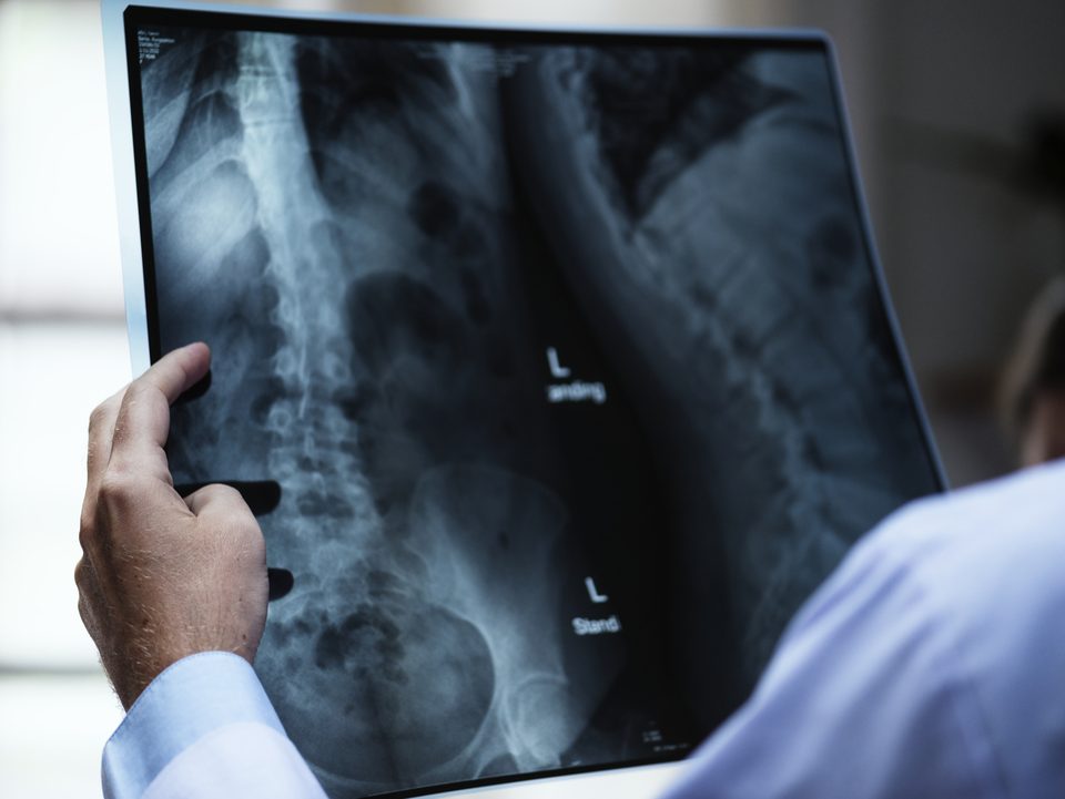 Exames de raio-x: médico observa exame de imagem de paciente.