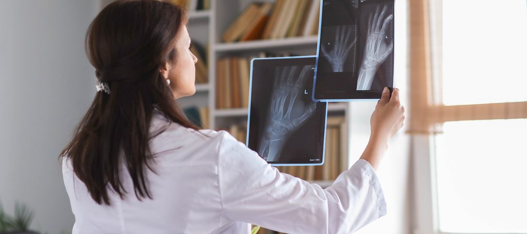 Telerradiologia: médica analisa exame de imagem.