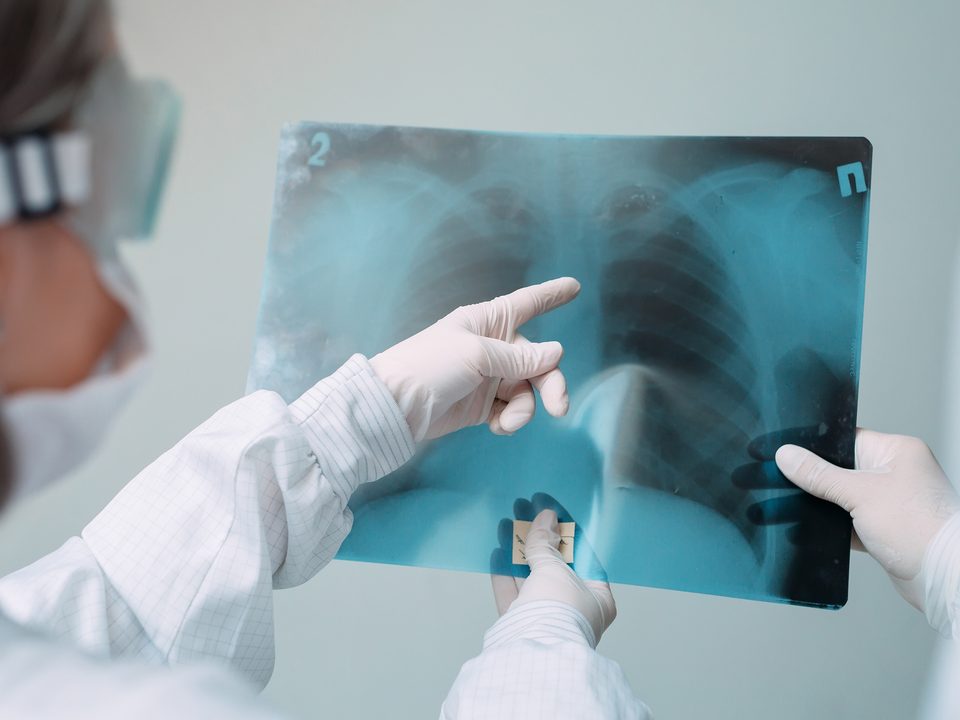 Doenças pulmonares: Doutores com máscaras e óculos examinam raio x do pulmão de um paciente