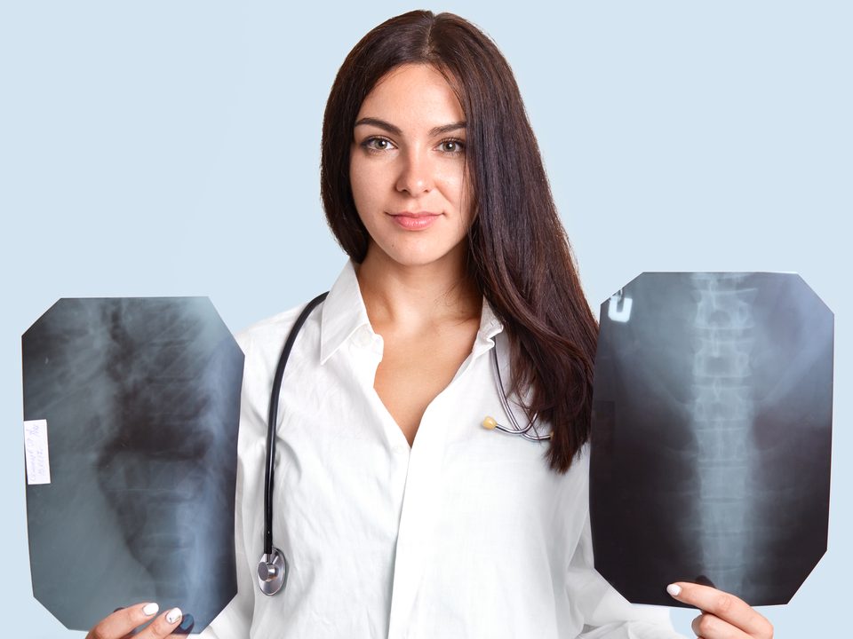 mulher segurando raio-x de coluna em cada mão