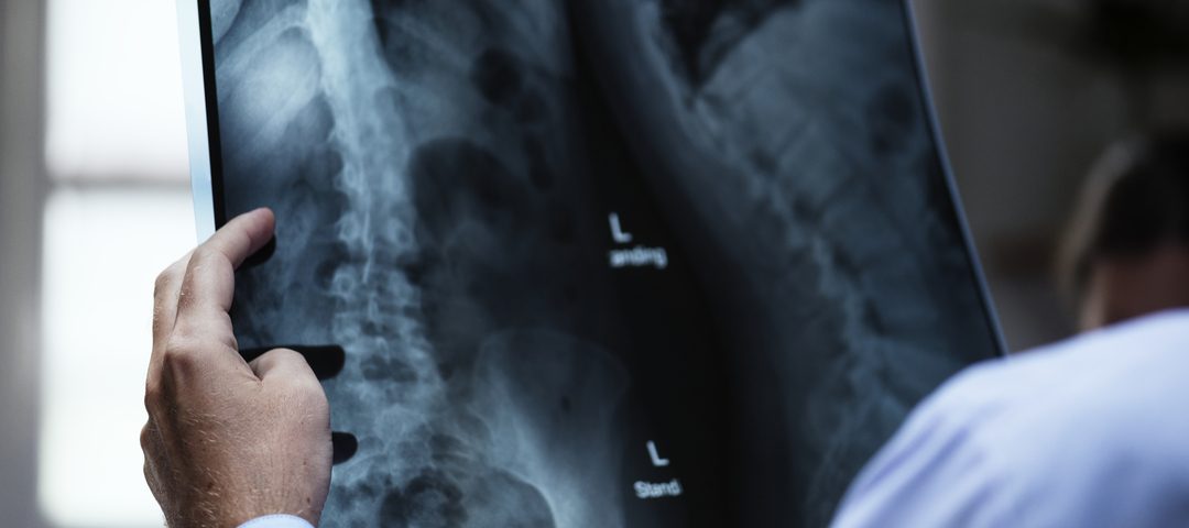 radiografia panorâmica: doutor analisando radiografia panorâmica de uma coluna