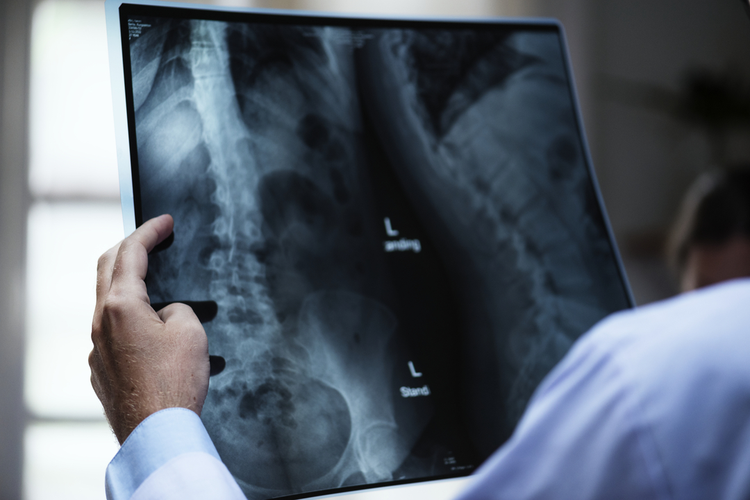 radiografia panorâmica: doutor analisando radiografia panorâmica de uma coluna